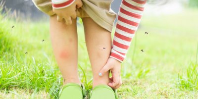 Holčička má štípance na nohách a škrábe se, kolem ní létá hmyz
