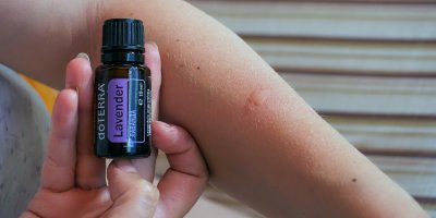 Ruka s komářím štípancem, levandulový olejíček