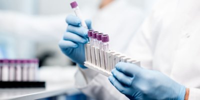 Laborant drží stojánek se zkumavkami