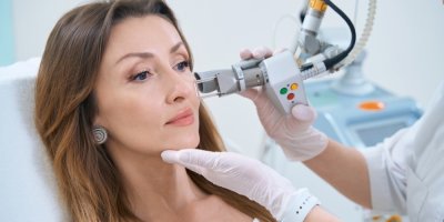 Ženě odstraňují laserem bradavici na obličeji na kosmetické klinice