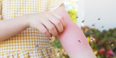 Komáři létající okolo načervenalé ruky malé holčičky