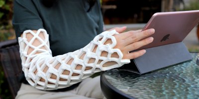 Žena sedí u stolu se sádrou na ruce