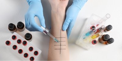 Testy na alergie