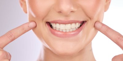 Mladá žena se směje a ukazuje prsty na své zuby