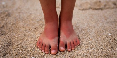 Spálené dětské nohy na písku