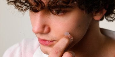 Chlapec si dává na pleť náplast na akné