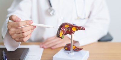 Doktor ukazuje tužkou na model jater