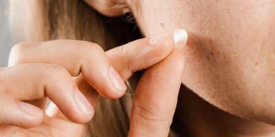 Nanášení náplasti na akné na pleť