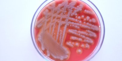 Detail růstu bakteriálních kolonií Bacillus cereus