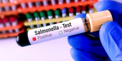 Člověk v modrých gumových rukavicích drží vzorek pro test na bakterii Salmonella