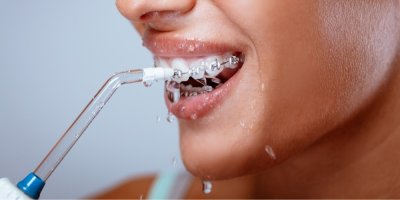 Žena s rovnátky si čistí zuby ústní sprchou