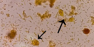 Mikroskopický snímek lamblie střevní