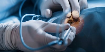 Laserová operace oka