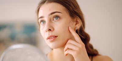 Žena s problematickou pletí