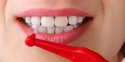 Ženská ústa a mezizubní kartáček