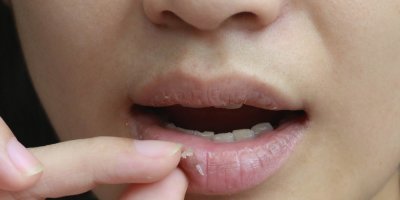 Žena se drží za popraskaný ret