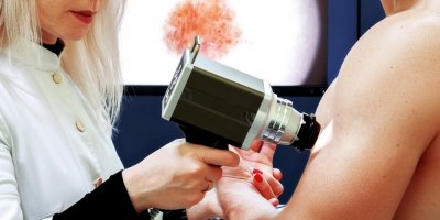 Dermatolog provádí vyšetření znaménka digitálním dermatoskopem 