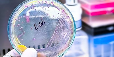 Petriho miska s koloniemi patogenní bakterie Escherichia coli
