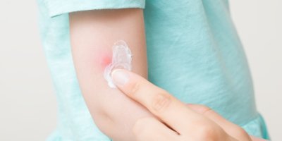 Žena aplikuje krém na podrážděnou pokožku dítěte
