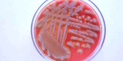 Detail růstu bakteriálních kolonií Bacillus cereus