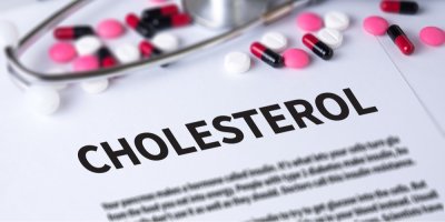 Léky na bílém pozadí s nápisem cholesterol