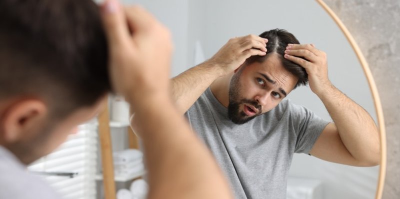 Dělá se vám akné ve vlasech? Může za to časté nošení čepice či nevhodný šampon