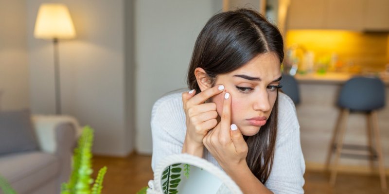 Akné v dospělosti: Proč se ho nemůžeme zbavit? Vymačkávání a sahání na obličej ho jen zhoršují