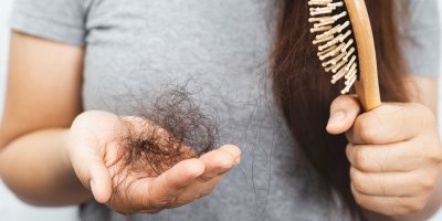 Padání vlasů může mít několik příčin.