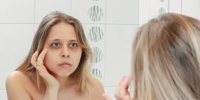 Mladá žena si v zrcadle znepokojeně prohlíží tmavé kruhy pod očima
