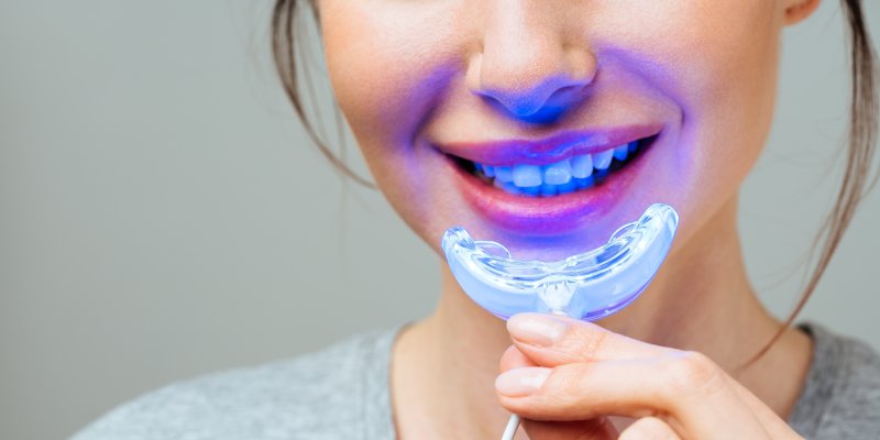 Bělicí pasty jsou jen marketing. Domácí bělení sodou a citronem nefunguje a poškozuje zdravé zuby, říká hygienistka