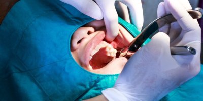 Ceny za zákroky u zubařů rostou, tak Češi jezdí do Turecka nebo Vietnamu. Riziko je velké, říká stomatolog