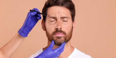 Kolik stojí odstranění kruhů pod očima nebo vrásek? Čím dál víc mužů řeší pleť a estetické zákroky, říkají odborníci