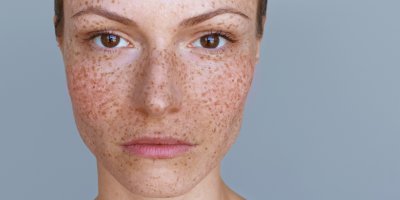 Dívky si sprejem na šediny stříkají umělé pihy. Virální beauty trend z TikToku už dorazil i do Česka