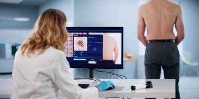 Před dovolenou si nechte zkontrolovat znaménka. Digitální dermatoskop může odhalit změny, které okem nevidíte