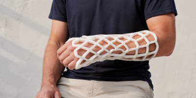 Sádra, která zachrání léto: Snese vodu ve vaně i bazén. Stojí i přes 4 000 Kč, pojišťovna může přispět