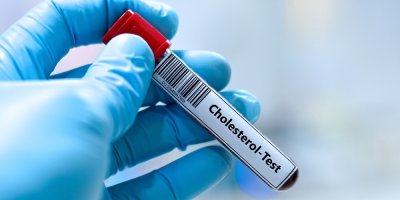 I způsob přípravy kávy ovlivňuje cholesterol. Nutriční terapeut vysvětluje, na co si dát pozor