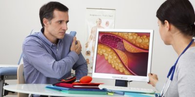 Cholesterol podle věku: Jaké hodnoty jsou v pořádku ve 20, 30, 40, 50 a více letech?